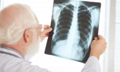 Thúc đẩy tiến trình chấm dứt bệnh lao ở Châu Á Thái Bình Dương