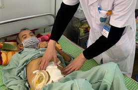 Người đàn ông ở Hà Nội nhiễm độc toàn thân sau bữa liên hoan