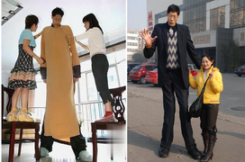 Cuộc đời gã 'quái vật' cao hơn 2m4 nhiều bất hạnh và cái kết viên mãn khó tưởng