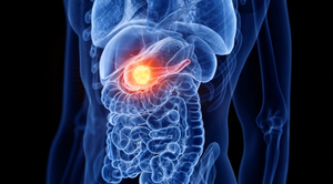 50% số ca ung thư tử vong vì phát hiện 'quá muộn': 10 dấu hiệu không nên bỏ qua