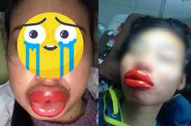 'Sang chấn tâm lý' với những màn phun xăm môi gây ám ảnh hơn cả ác mộng