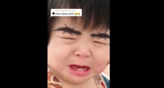 Bé con khóc lớn vì lông mày biến hình