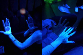 Đi tiệc, cô gái hoảng khi cơ thể bỗng phát sáng như zombie, lý do gây rùng mình