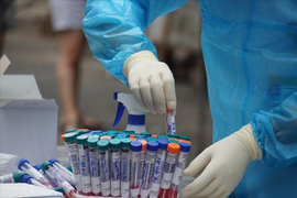 COVID-19 sáng 27/1: F0 ở Sơn La tăng cao, TP.HCM tiêm vaccine xuyên Tết