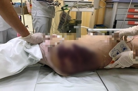 Bé gái 8 tuổi bị 'dì ghẻ' hành hạ đến chết: Công an kết luận nguyên nhân tử vong