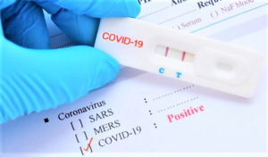 COVID-19 căng thẳng, kit test rơi vào 'tầm ngắm' kiểm tra