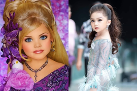 2 Hoa hậu nhí chịu cảnh 'chín ép': Bị mẹ ép tiêm botox, trang điểm già dặn