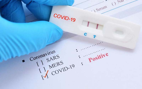 Các triệu chứng của COVID-19 rõ ràng nhưng vì sao test nhanh vẫn âm tính?