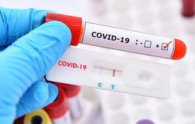 Khi nào mới cần test nhanh COVID-19?