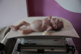 LHQ kêu gọi thế giới không lãng quên 19 triệu người đói nghèo ở Yemen