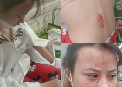 Hà Tĩnh: Khởi tố gã hàng xóm đánh nữ sinh lớp 10 chấn động não