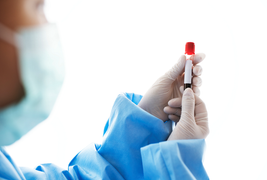 Không nhất thiết phải test COVID-19 thường xuyên cho mọi trẻ sơ sinh