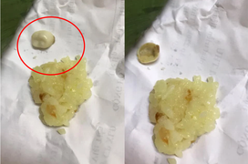 Đang ăn xôi bất ngờ nhai trúng vật lạ ‘ghê rợn’, cô gái băn khoăn có nên ăn tiếp