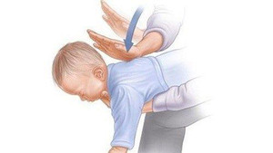 Làm gì khi trẻ bị hóc dị vật?