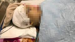 Phó Chủ tịch UBND xã ở Hải Dương bị đánh trọng thương khi làm nhiệm vụ