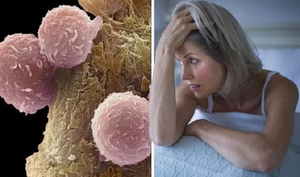 Chuyên gia cảnh báo: Thiếu ngủ làm tăng nguy cơ mắc 4 căn bệnh ung thư nguy hiểm