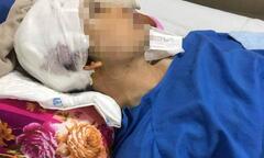 Phó Chủ tịch xã ở Hải Dương bị đánh trọng thương: Tạm giữ hai người