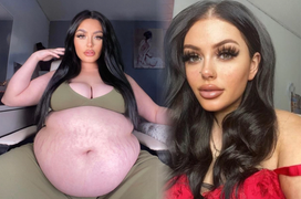 Cô gái kiếm gần 300 triệu/tháng từ việc khoe chiếc bụng mỡ quá khổ của mình