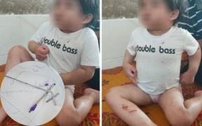 Tạm giữ dì ruột dùng chổi sắt đánh cháu gái 4 tuổi nhập viện