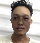 Dùng dao đâm nhân tình của người yêu cũ nguy kịch