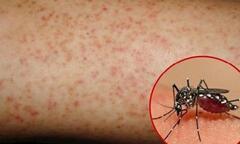 Mẹ bầu mắc sốt xuất huyết có nguy hiểm cho thai nhi?
