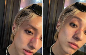 Nam ca sĩ bị đánh trên phố Hàn Quốc chỉ vì là người đồng tính