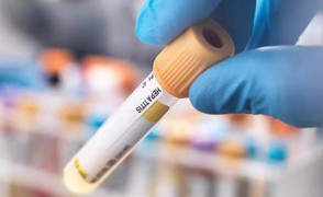 Sợ viêm gan bí ẩn, cha mẹ tự xét nghiệm men gan cho con: Hệ luỵ nguy hiểm