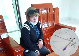 Khởi tố dì ruột dùng cán chổi đánh cháu gái 4 tuổi nhập viện