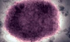 Mạng xã hội Trung Quốc rộ thuyết âm mưu Mỹ là nguồn phát tán virus đậu mùa khỉ