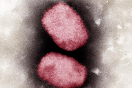 Bỉ giải trình tự gen của virus gây bệnh đậu mùa khỉ