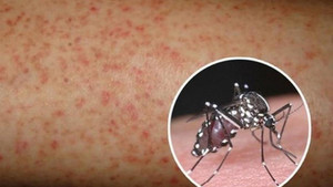 Nguy cơ bùng phát dịch sốt xuất huyết ở TP.HCM, nhiều người vẫn chủ quan