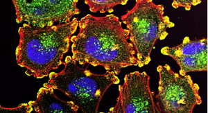 Thuốc thử nghiệm chữa khỏi 100% bệnh ung thư gây nhiều tranh cãi