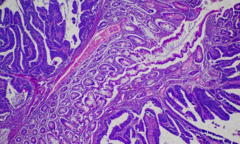Trước Dostarlimab, thuốc ung thư được nghiên cứu thế nào?