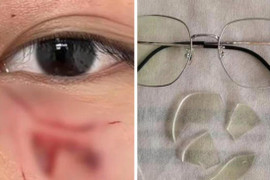 Đấm rách mặt học sinh, giáo viên ở Trung Quốc bị sa thải