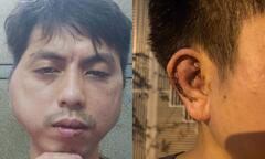 Hà Nội: Thanh niên tố bị chủ quán đánh thủng màng nhĩ vì xin nghỉ việc