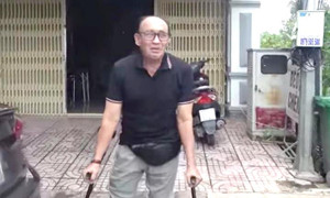 Danh hài Duy Phương gặp tai nạn giao thông phải chống nạng để di chuyển