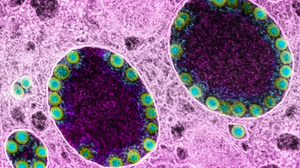 Các triệu chứng có thể gặp khi nhiễm biến chủng BA.5 của Omicron