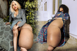 Mang một bên chân nặng 45kg, cô gái vượt đau đớn tự tin trở thành người mẫu