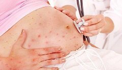 Thai phụ mắc sốt xuất huyết nguy cơ cao băng huyết sau sinh, bác sĩ khuyên gì?