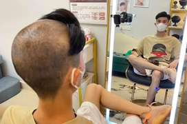 Khi các chàng trai cũng 'đau đầu' vì những màn làm đẹp thảm họa