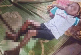 Xác minh thông tin bé trai ở Đắk Lắk trộm trái cây bị tẩm xăng đốt