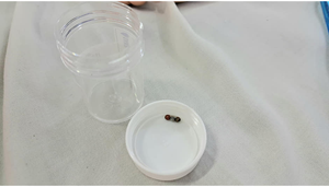 Bé gái 3 tuổi thủng ruột vì món đồ chơi quen thuộc