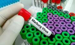 Mức độ nguy hiểm của loại virus chưa có vaccine, tỷ lệ tử vong cao