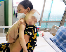 Hai anh em bị suy thận cấp do uống vitamin D quá liều 