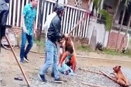 Bé 8 tuổi ở Bình Phước bị chó Pitbull cắn tử vong