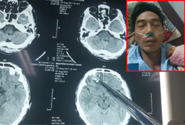 Yêu cầu điều tra vụ dân tố bị đánh nhưng công an huyện ở Gia Lai không khởi tố