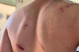 Khởi tố cha và bà nội đánh đập dã man cháu bé 9 tuổi ở Đắk Lắk