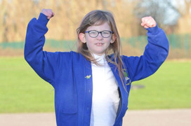 ‘Cô bé siêu nhân’ độc nhất thế giới: Không đói, không cần ngủ và không thấy đau