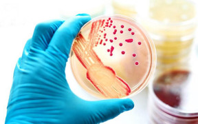 Những ai nguy cơ cao mắc bệnh đậu mùa khỉ?