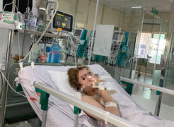 Vụ ngộ độc rượu tại TP.HCM: Thêm một nạn nhân nguy kịch, tổn thương não